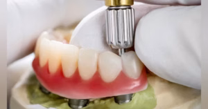 dental crown