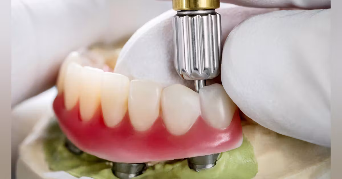 dental crown